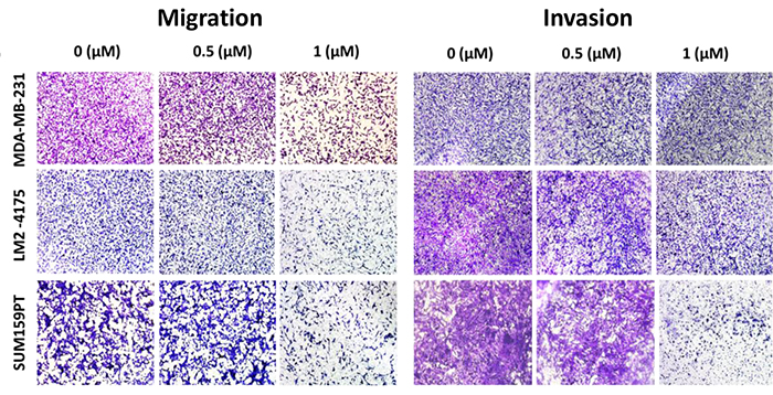 triple-negative breast cancer